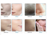 7 in 1 Aqua Hydra Hydro Peeling Facial Dermabrasion Machine Facial Skin Care 18253101
